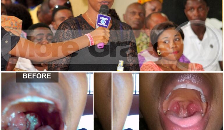 DANGEROUS OPERATION AVOIDED AND ADENOIDS HEALED
