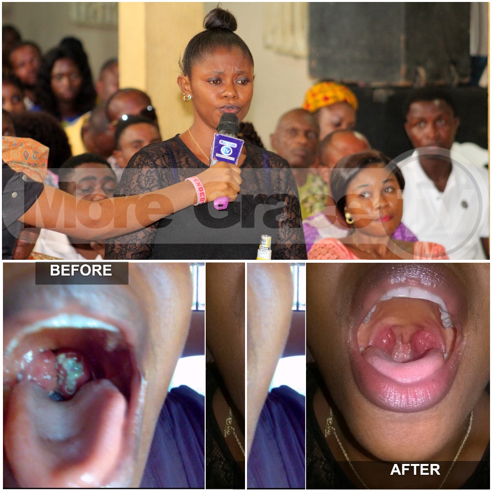 DANGEROUS OPERATION AVOIDED AND ADENOIDS HEALED